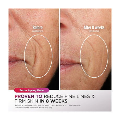 Shark CryoGlow Máscara Facial | InstaChill | Skin Sustain | Better Ageing | Blemish Repair