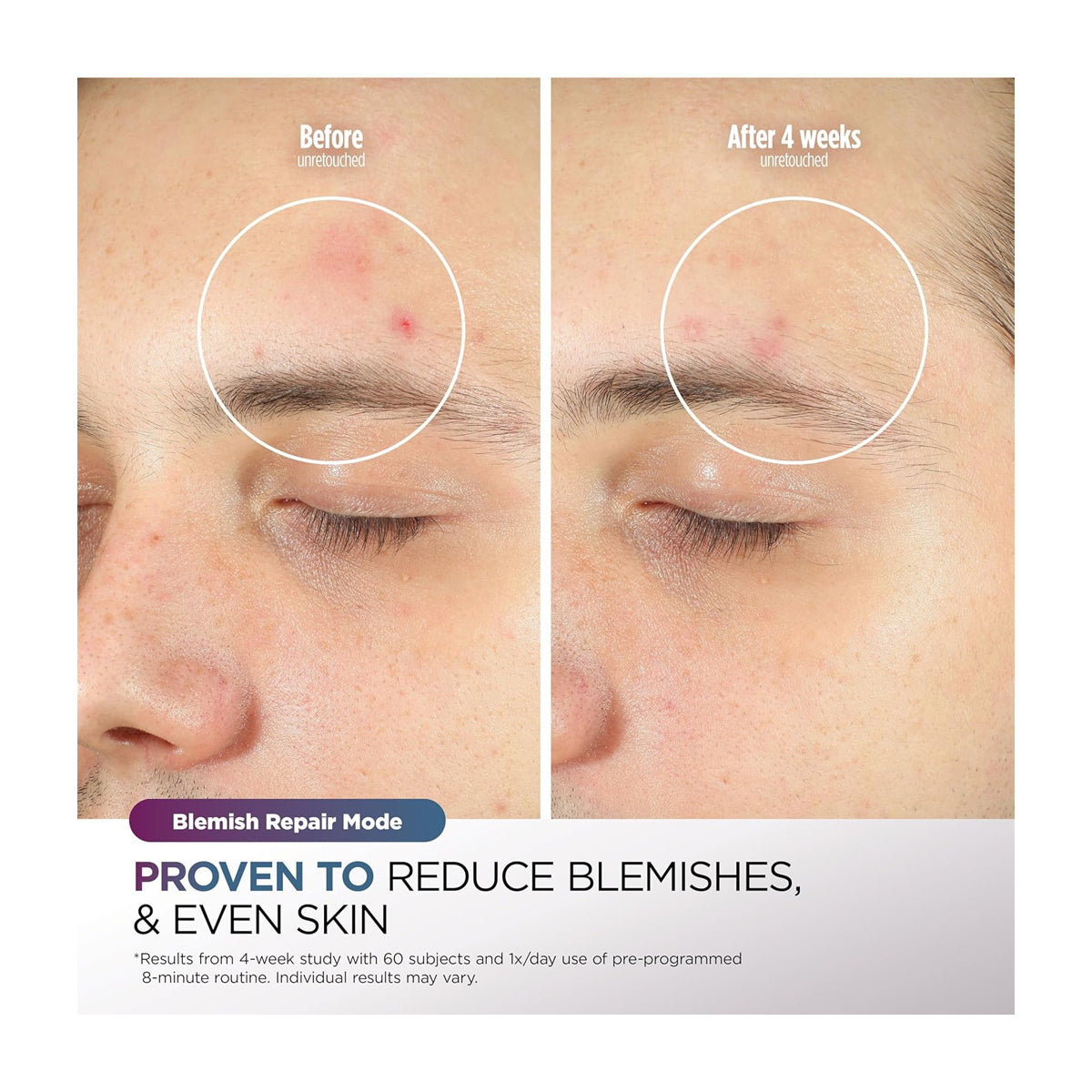 Shark CryoGlow Máscara Facial | InstaChill | Skin Sustain | Better Ageing | Blemish Repair