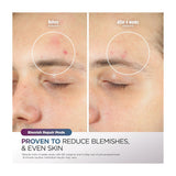Shark CryoGlow Máscara Facial | InstaChill | Skin Sustain | Better Ageing | Blemish Repair