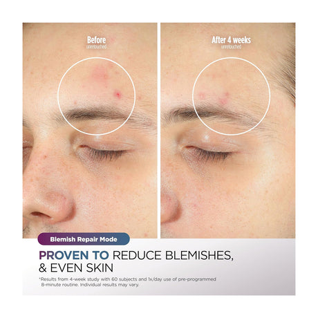 Shark CryoGlow Máscara Facial | InstaChill | Skin Sustain | Better Ageing | Blemish Repair
